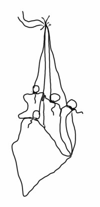 Collect the strings together